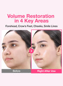 No.2 Rose PDRN Collagen Plumping Sheet Mask (1ea / 33ml)