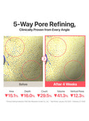 No.3 Bifida Bakuchiol Zero Pore Cleansing Oil (200ml)
