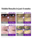 No.9 NAD+ Retinol Volumetox Eye Cream (10ml)