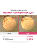 TXA 5 Brightening Hydrogel Eye Patch (90g/90patches)