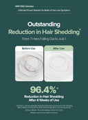 Scalp Shampoo (500ml)