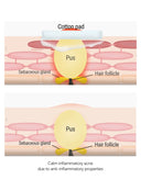mandelic-acid-5-skin-prep-water-120ml