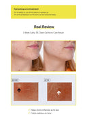 sulfur-3-clean-gel-30g