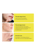 sulfur-3-clean-gel-30g