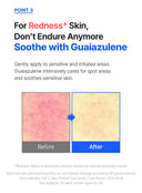 PH Sensitive Spot Cream (30ml)